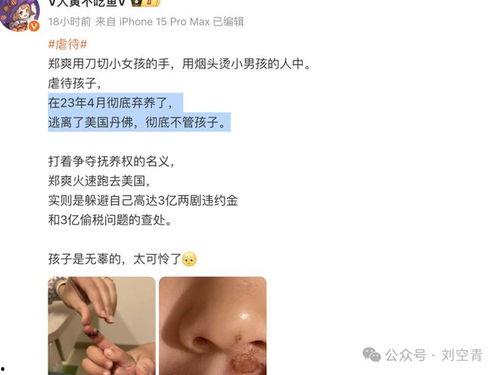 吃瓜爆料免费进最新网站,免费畅游吃瓜爆料最新网站，独家攻略大公开！